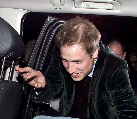 is prince william balding prince william. between Prince William of